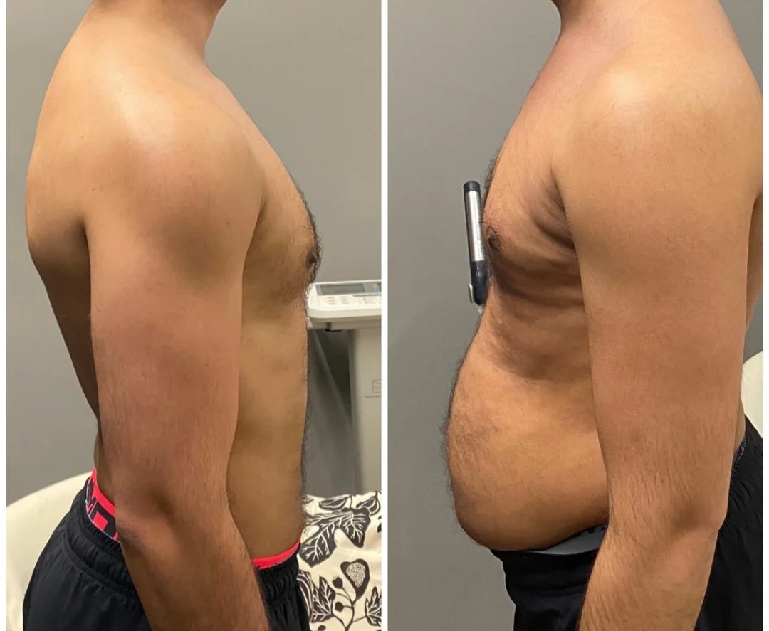 Client Transformation